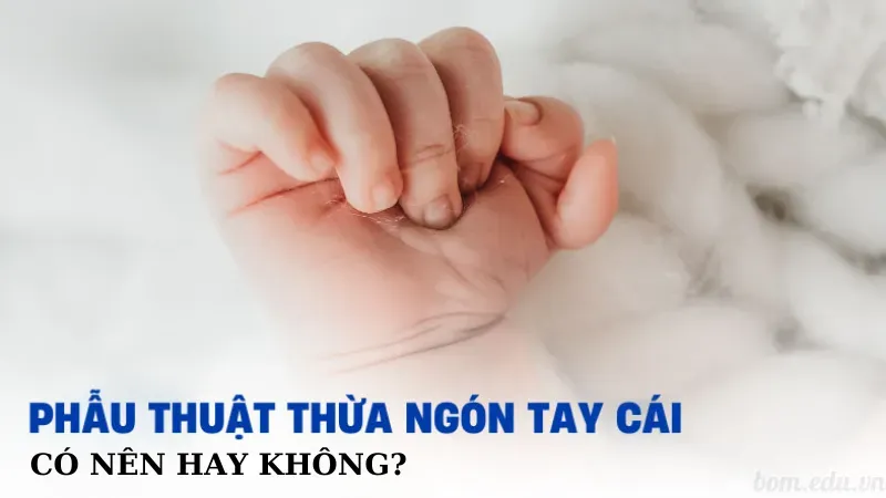 Có nên phẫu thuật tay 6 ngón để thay đổi vận mệnh không