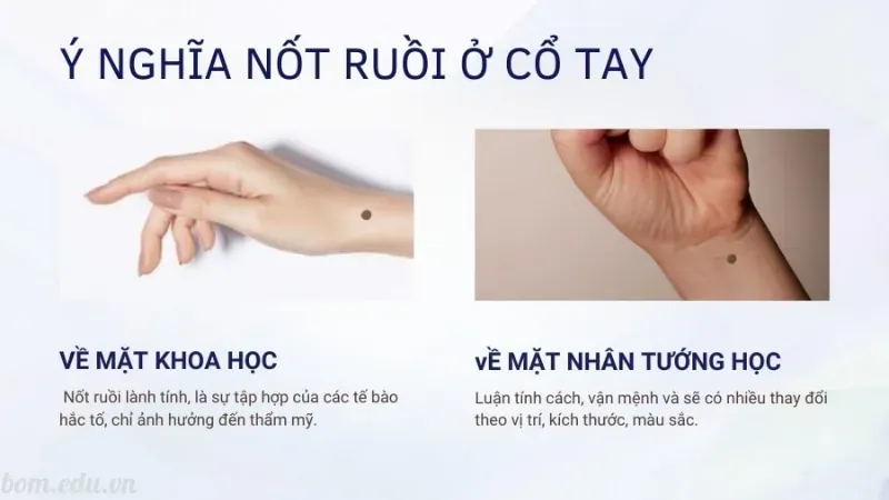 Nốt ruồi ở cổ tay