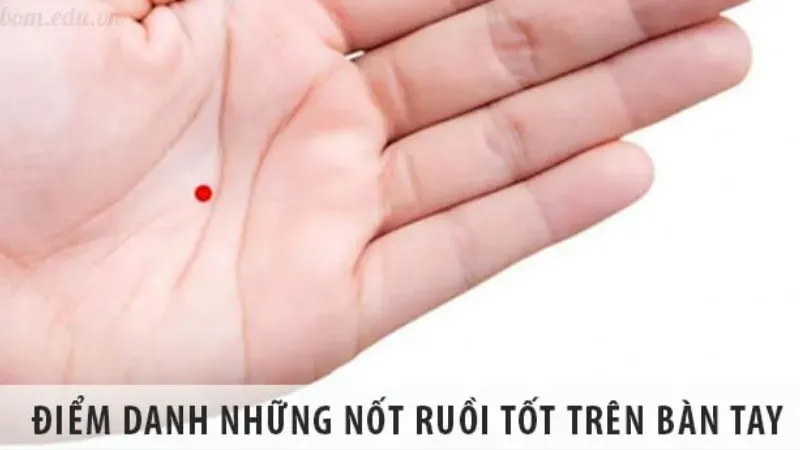 Nốt ruồi son trên tay có ý nghĩa gì?