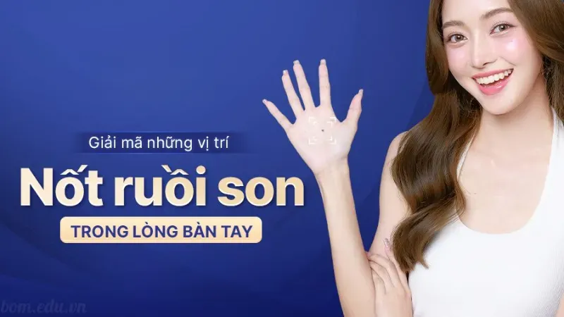 Nốt ruồi son trong lòng bàn tay