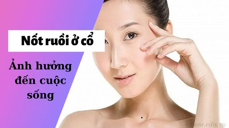 Ảnh hưởng của nốt ruồi ở cổ đến cuộc sống