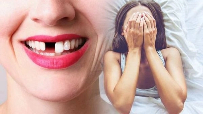 Mơ thấy rụng răng nanh