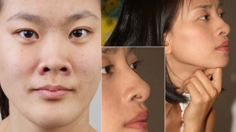 Tướng mũi rộng thể hiện khả năng quản lý tài chính tốt