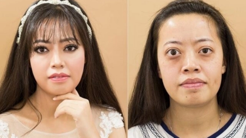 Ý nghĩa, tài vận và phong thủy cho người mắt lồi