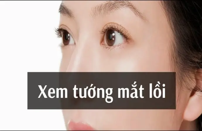 Giải mã tướng người mắt lồi và ý nghĩa trong tướng số