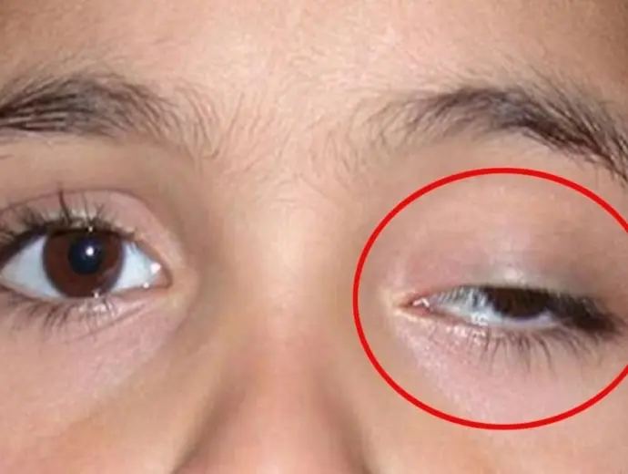 Mắt giật bên trái có điềm gì? Giải mã tâm linh hiện tượng