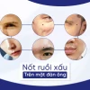 Giải mã tướng số: Xem nốt ruồi trên mặt đàn ông theo phong thủy