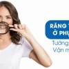 Răng Thưa Trong Tướng Số: Giải Mã Vận Mệnh và Ý Nghĩa