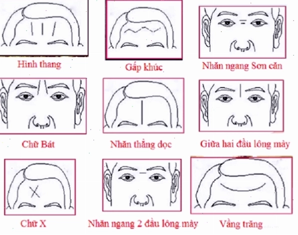 Các loại nếp nhăn trên trán có ý nghĩa gì? Cách xóa nếp nhăn trán hiệu quả | VITA Clinic