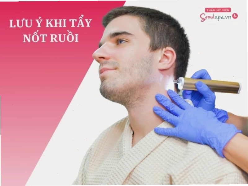 Chăm sóc nốt ruồi sau khi tẩy