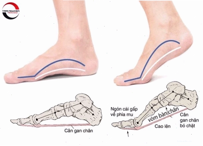 Coi tướng bàn chân nam qua độ dài và sự khép kín của các ngón chân