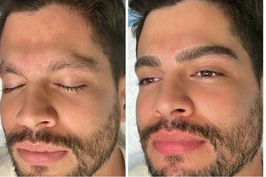 Điêu khắc chân mày nam tại Ngọc Dung mang đến kết quả khác biệt, an toàn, chất lượng