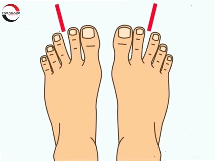 Minh họa ngón chân cái dài hơn ngón trỏ