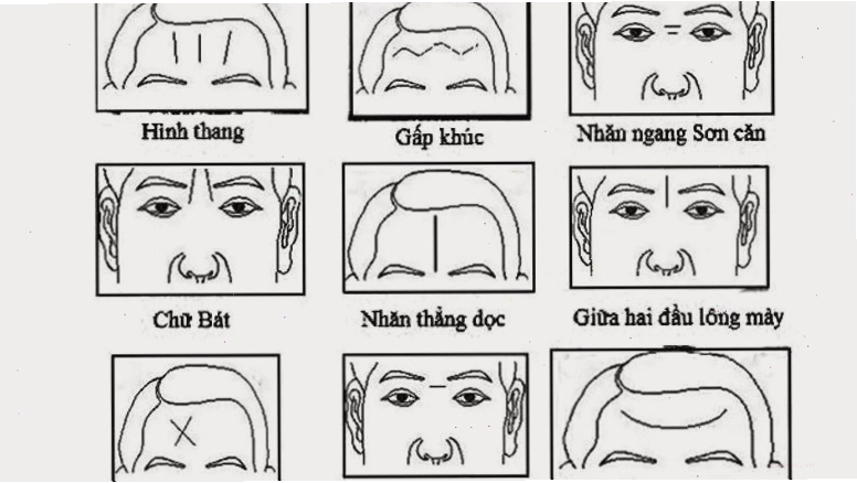 Nếp nhăn trên trán hình chữ M mang lại tài lộc