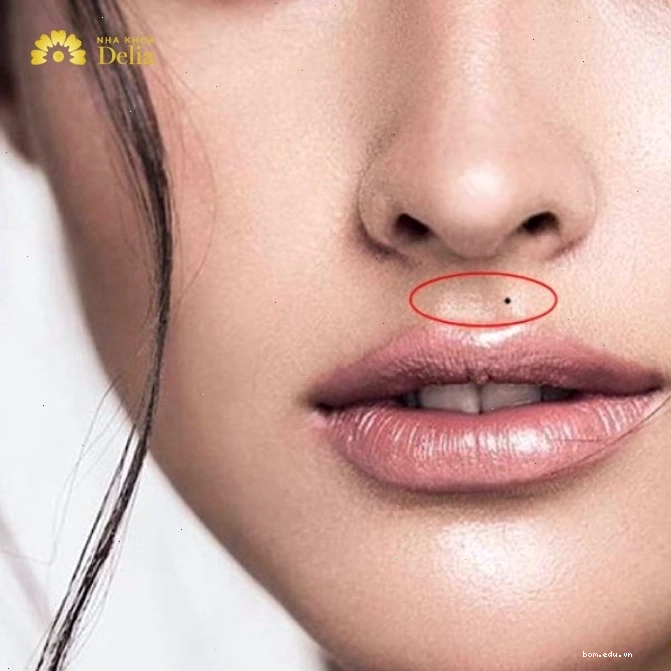 Nhân trung có nốt ruồi ở phụ nữ theo quan niệm dân gian