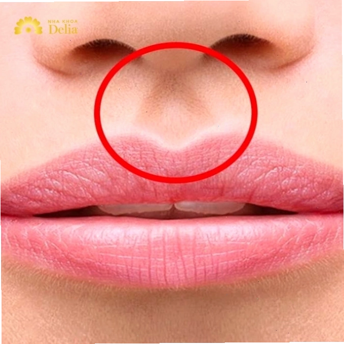 Nhân trung là một rãnh nhỏ nằm ở giữa mũi và môi trên của khuôn mặt