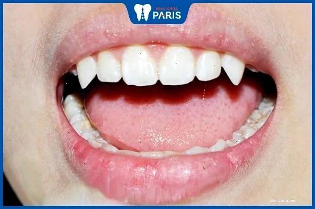 Phụ nữ có răng nhọn, đều đẹp thường thông minh và có cuộc sống thuận lợi