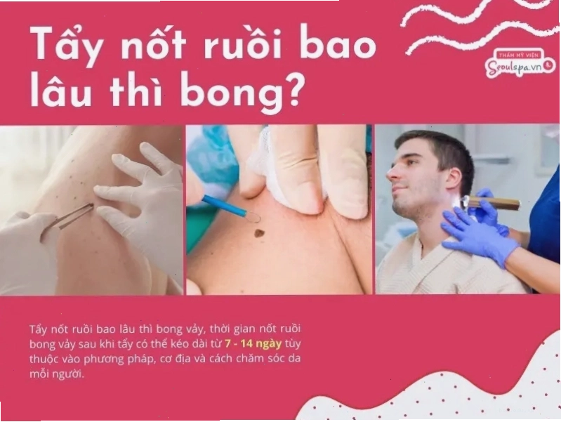 Quá trình hồi phục sau khi tẩy nốt ruồi