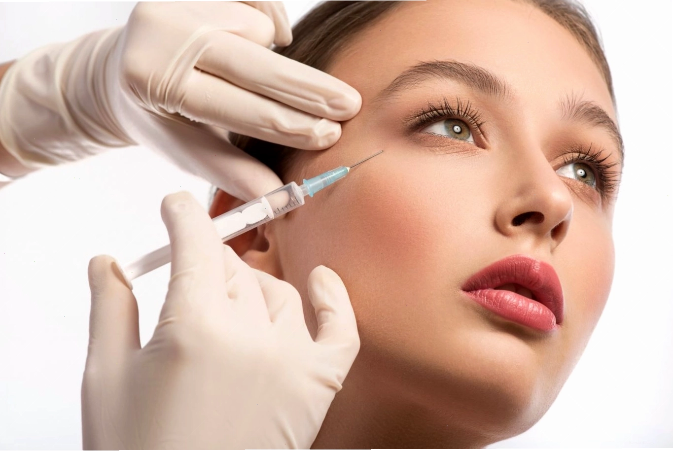 Tiêm chất làm đầy khắc phục thái dương lõm