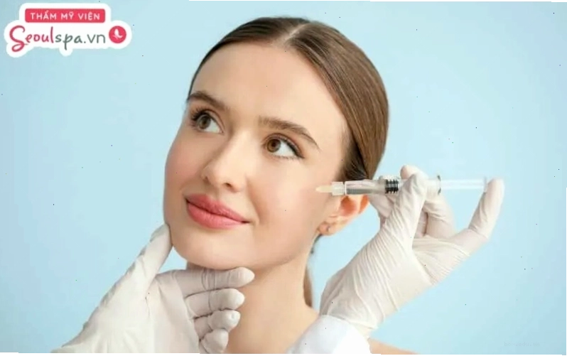 Tiêm filler là phương pháp làm đầy rãnh cười tức thì mà không can thiệp xâm lấn, phẫu thuật