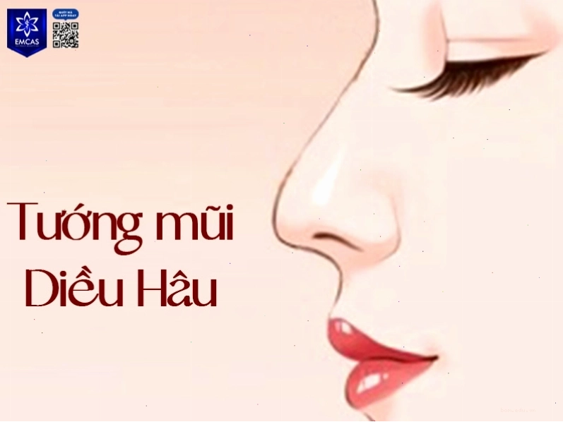 Tướng mũi diều hâu với sống mũi cao và đầu mũi khoằm