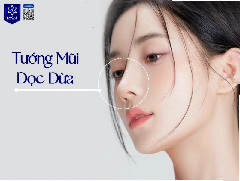 Tướng mũi dọc dừa thanh thoát và hài hòa