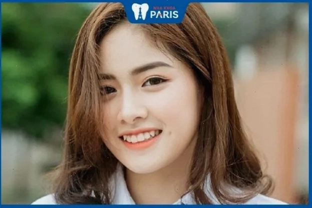 Tướng răng chó ở phụ nữ có thể báo hiệu đường tình duyên không mấy thuận lợi