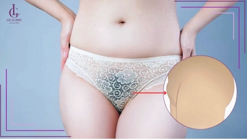 Xương mu nhô cao kèm lông rậm dự báo nhiều điều thú vị