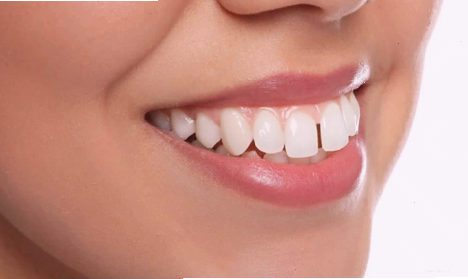 Ý nghĩa hàm răng hô và hở lợi trong nhân tướng học