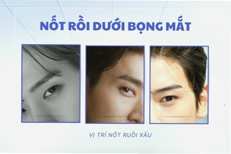 Ý nghĩa nốt ruồi trên mũi và má đàn ông