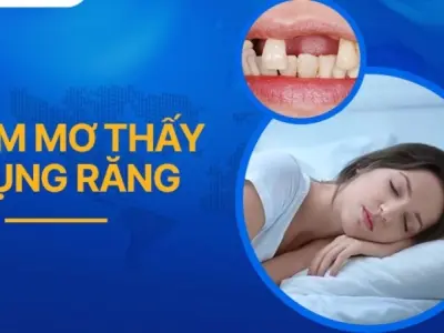 Nằm mơ thấy rụng răng báo trước điều gì về sức khỏe