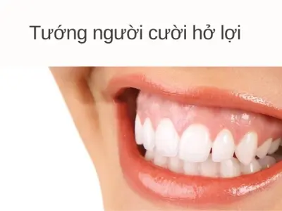 Tướng người cười hở lợi nói lên điều gì về tính cách