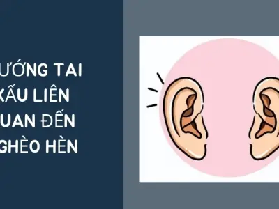 Khám phá ý nghĩa tướng tai nghèo hèn trong nhân tướng học