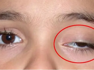 Mắt giật bên trái có điềm gì? Giải mã tâm linh hiện tượng