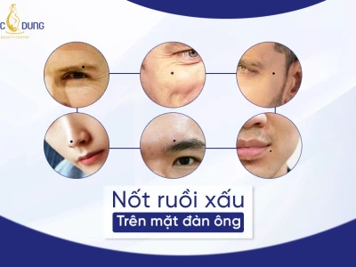 Giải mã tướng số: Xem nốt ruồi trên mặt đàn ông theo phong thủy