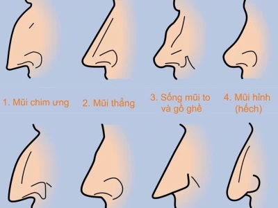 Khám phá các dáng mũi trong nhân tướng học và ý nghĩa phong thủy