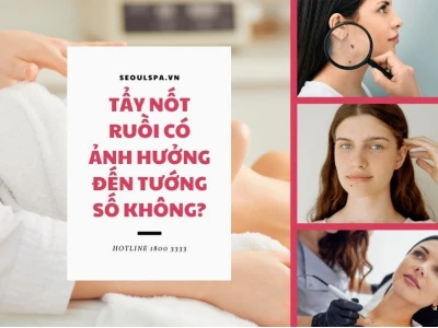 Tẩy nốt ruồi có ảnh hưởng đến tướng số không và sức khỏe?