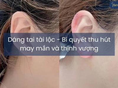 Xem Tướng Tai Đàn Ông: Dự Đoán Vận Mệnh Sang Giàu Qua Hình Dáng